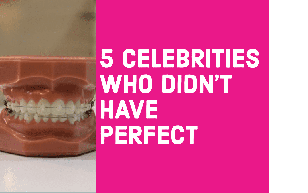 5 Celebrities Who Didn’t Have Perfect Teeth