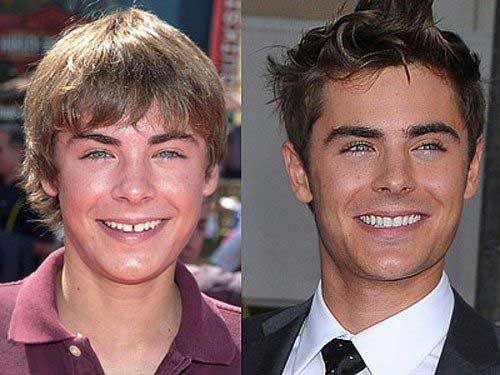 Zac-Efron-Bad-Smile